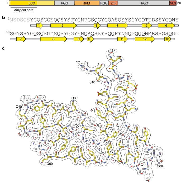 Nature:科學(xué)家識(shí)別出與人類額顳葉癡呆癥發(fā)生相關(guān)的新型蛋白質(zhì) Nature:科學(xué)家識(shí)別出與人類額顳葉癡呆癥發(fā)生相關(guān)的新型蛋白質(zhì)